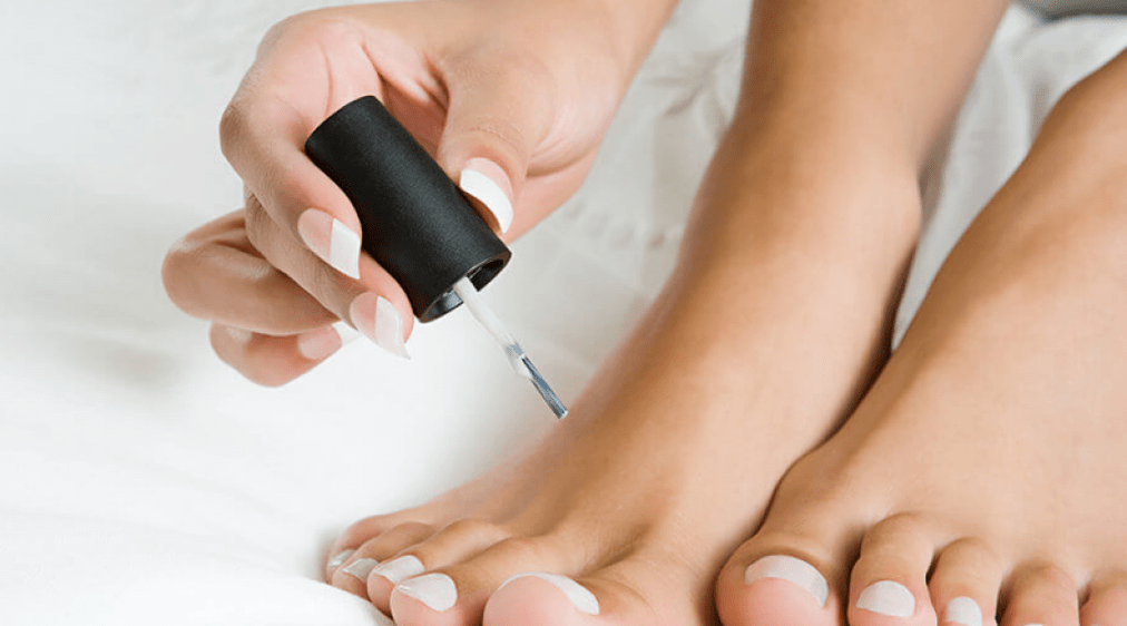 behandeling van schimmel op de duim met nagellak