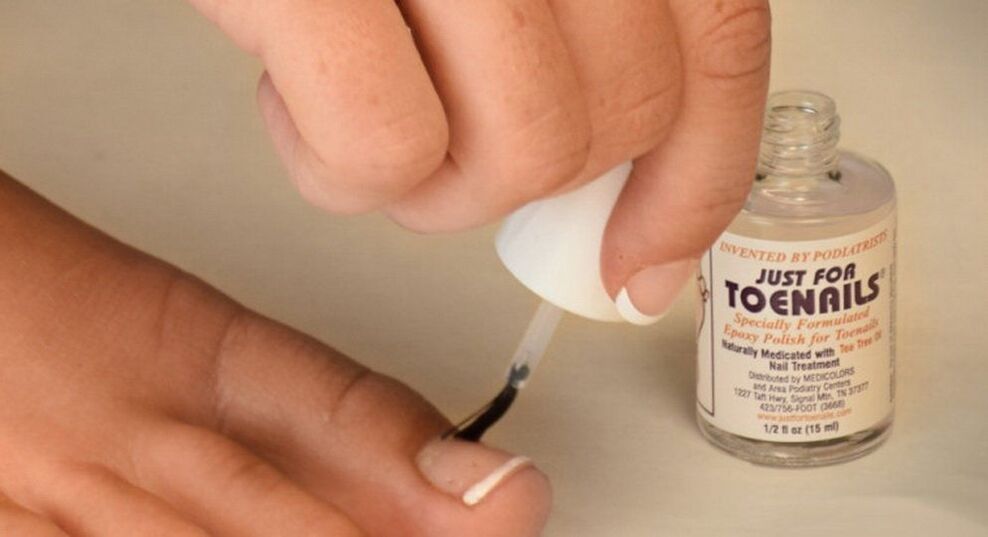 nagellak tegen schimmel op de grote teen