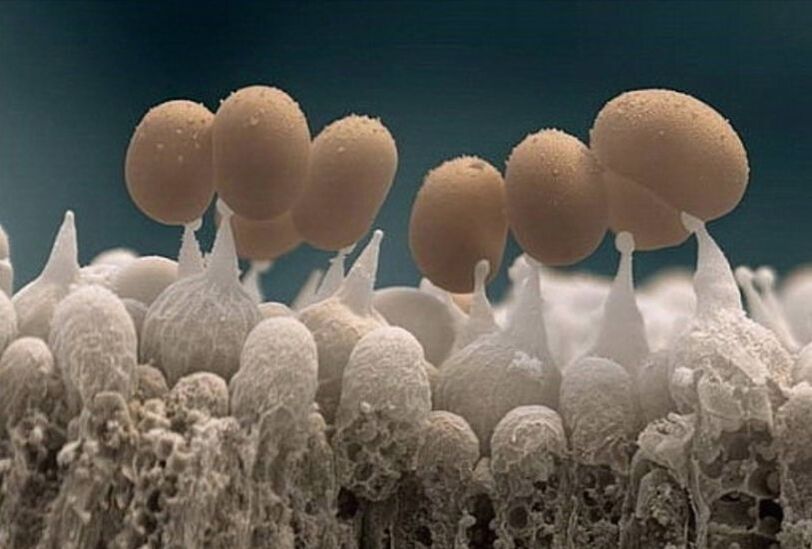 teennagelschimmel onder een microscoop
