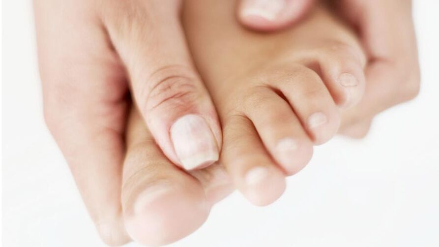 jeuk door nagelschimmel aan de grote teen