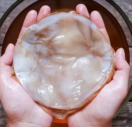 nagelschimmel kombucha