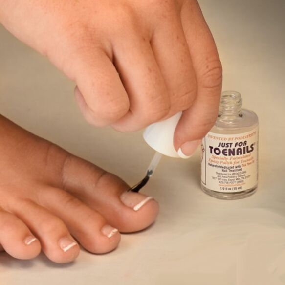 schimmelvernis wordt gebruikt in de vroege stadia van een nagelschimmelinfectie